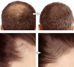 Beard &amp; Hairline Fill-Up Stick